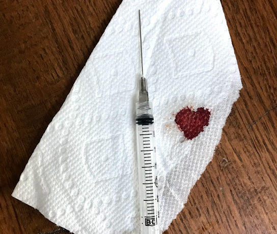 An injection needle for IVF